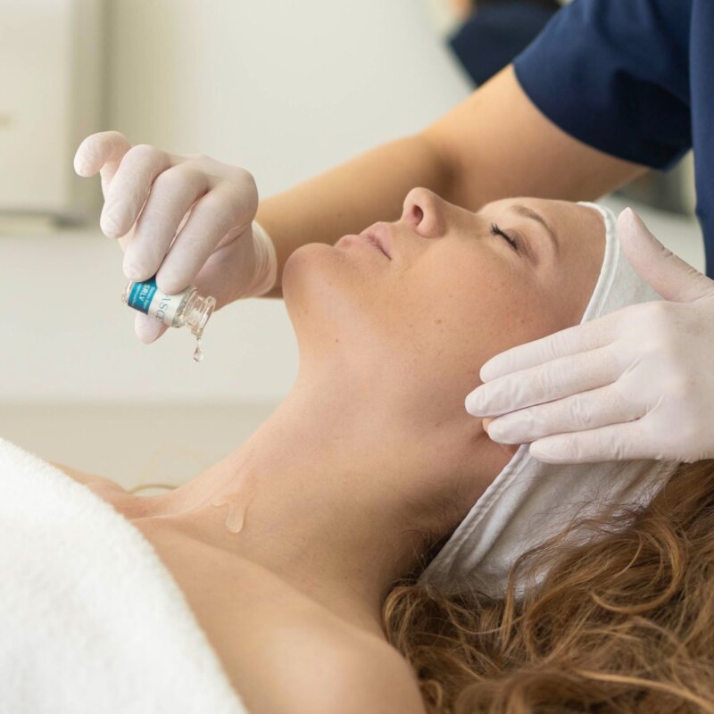 Eksosoomid mikronõelumisega protseduur naha noorendamiseks Medemis kliinikus