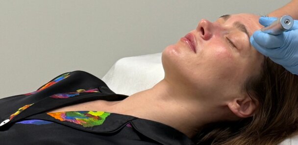 Keemiline koorimine Medemis kliinik – naha uuendamine