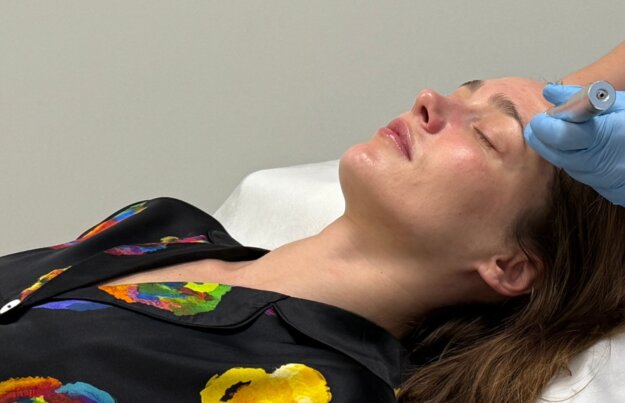 Keemiline koorimine Medemis kliinik – naha uuendamine